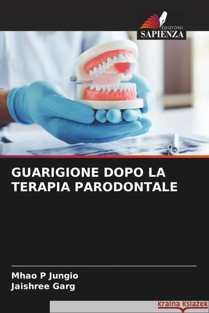 Guarigione Dopo La Terapia Parodontale Mhao P Jungio Jaishree Garg  9786205913383 Edizioni Sapienza - książka