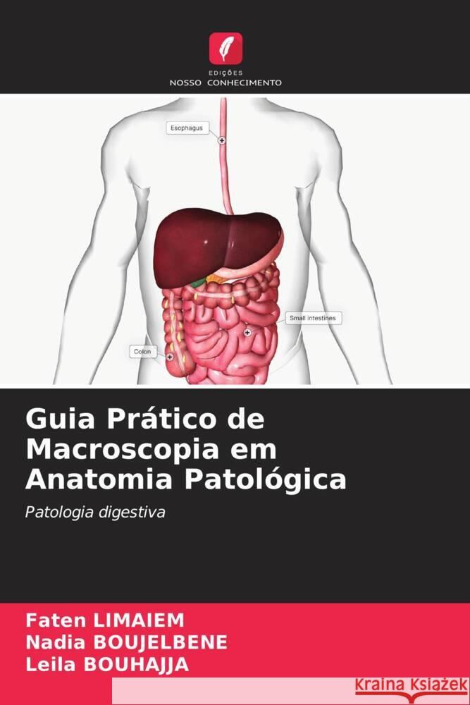 Guia Prático de Macroscopia em Anatomia Patológica Limaiem, Faten, BOUJELBENE, Nadia, BOUHAJJA, Leila 9786200458773 Edições Nosso Conhecimento - książka