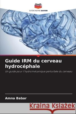 Guide IRM du cerveau hydrocéphale Amna Babar 9786204159416 Editions Notre Savoir - książka