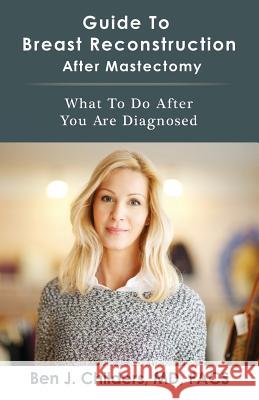 Guide To Breast Reconstruction After Mastectomy: What To Do After You Are Diagnosed Childers, Ben 9781519243041 Createspace - książka