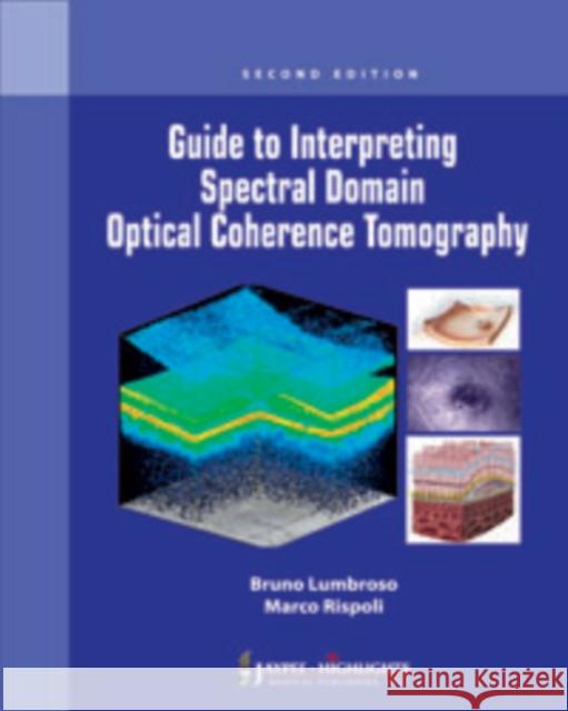 Guide to Interpreting Spectral Domain Optical Coherence Tomography Bruno Lumbroso   9789350253847 Jaypee Brothers Medical Publishers - książka