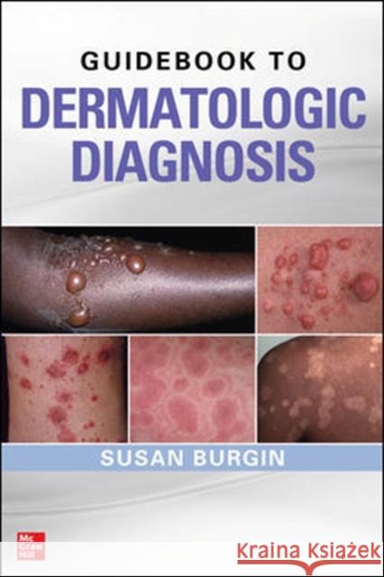 Guidebook to Dermatologic Diagnosis Susan Burgin 9780071738750 McGraw-Hill Education - Europe - książka