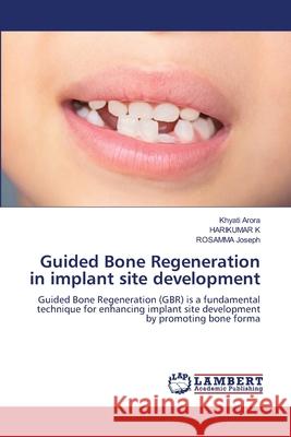 Guided Bone Regeneration in implant site development Khyati Arora Harikumar K Rosamma Joseph 9786208450373 LAP Lambert Academic Publishing - książka