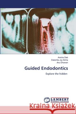 Guided Endodontics Anisha Deb Dakshita Joy Sinha Anu Dhawan 9786207487516 LAP Lambert Academic Publishing - książka