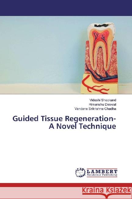 Guided Tissue Regeneration- A Novel Technique Sheokand, Vidushi; Deswal, Himanshu; Chadha, Vandana Srikrishna 9783330051515 LAP Lambert Academic Publishing - książka