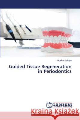 Guided Tissue Regeneration in Periodontics Vrushali Lathiya 9786203308150 LAP Lambert Academic Publishing - książka