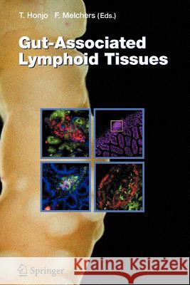 Gut-Associated Lymphoid Tissues Tasuku Honjo Fritz Melchers 9783642067945 Not Avail - książka