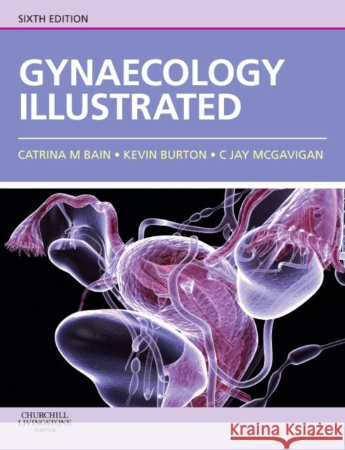 Gynaecology Illustrated Catrina Bain 9780702030673  - książka