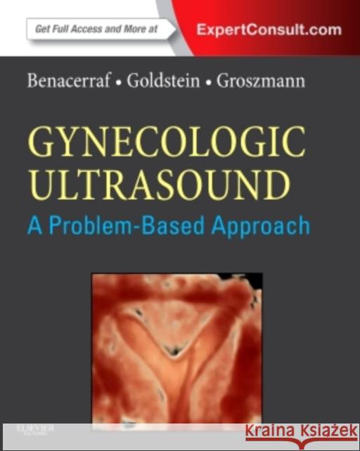Gynecologic Ultrasound: A Problem-Based Approach Beryl R. Benacerraf Steven R. Goldstein Yvette Groszmann 9781437737943 W.B. Saunders Company - książka