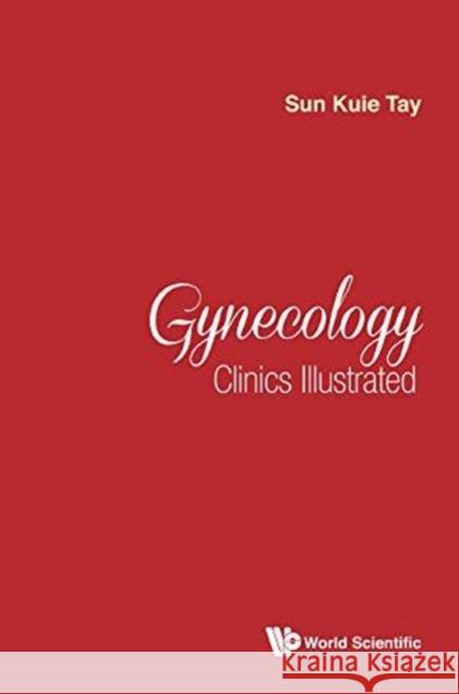 Gynecology Clinics Illustrated Sun Kuie Tay (S'pore General Hospital, S   9789813229037 World Scientific Publishing Co Pte Ltd - książka