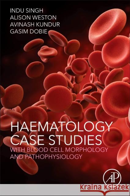 Haematology Case Studies with Blood Cell Morphology and Pathophysiology Indu Singh Alison Weston Avinash Kundur 9780128119112 Academic Press - książka
