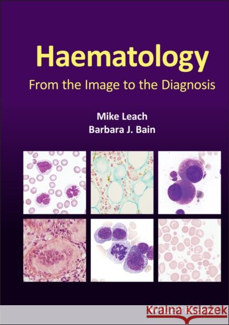 Haematology: From the Image to the Diagnosis Mike Leach Barbara J. Bain 9781119777502 Wiley-Blackwell - książka