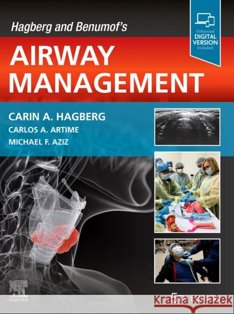 Hagberg and Benumof's Airway Management Carin A. Hagberg 9780323795388 Elsevier - książka