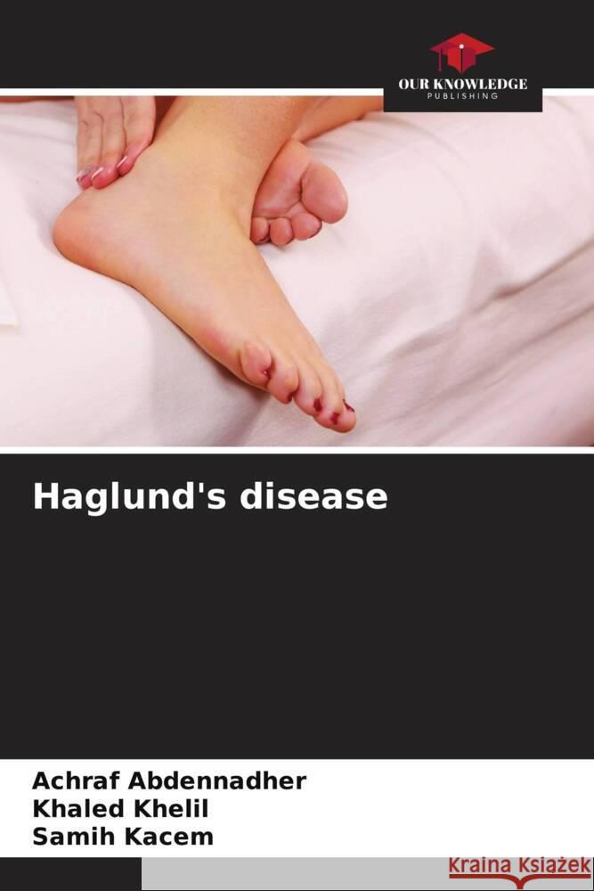 Haglund's disease Achraf Abdennadher Khaled Khelil Samih Kacem 9786206847069 Our Knowledge Publishing - książka