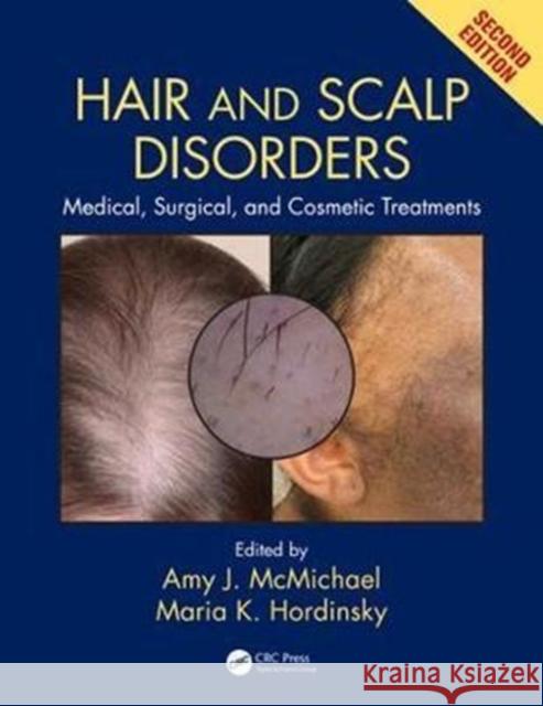 Hair and Scalp Disorders: Medical, Surgical, and Cosmetic Treatments, Second Edition Amy J. McMichael 9781842145920 CRC Press - książka