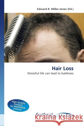 Hair Loss Miller-Jones, Edward R. 9786130108854 FastBook Publishing - książka