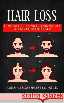 Hair Loss: Ultimate Guide To Learn About Hair Loss Prevention Methods And Regrowth Treatment (Natural Hair Growth Secrets & Hair Clark Ranfield 9781774859780 Darby Connor - książka