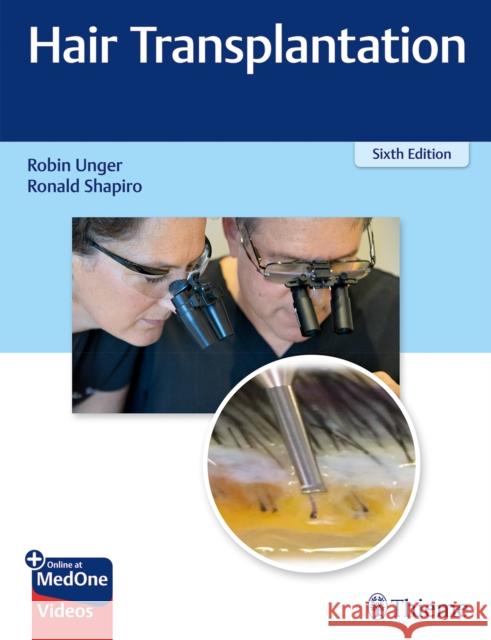 Hair Transplantation Robin Unger Ronald Shapiro 9781626236936 Thieme Medical Publishers - książka