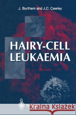 Hairy-Cell Leukaemia Burthem, John 9781447112563 Springer - książka