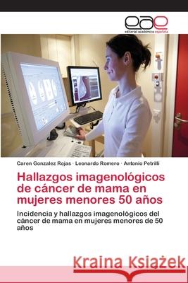 Hallazgos imagenológicos de cáncer de mama en mujeres menores 50 años Gonzalez Rojas, Caren 9786202114561 Editorial Académica Española - książka