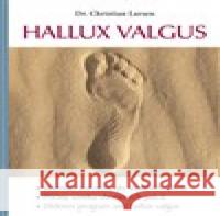 Hallux valgus Christian Larsen 9788088395201 Poznání - książka