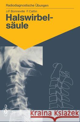 Halswirbelsäule: 60 Diagnostische Übungen Für Studenten Und Praktische Radiologen Bonneville, Jean-Francois 9783540176855 Springer - książka