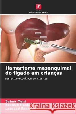 Hamartoma mesenquimal do fígado em crianças Mani, Salma, Nahla, Kechich, Sahnoun, Lassaad 9786208741372 Edições Nosso Conhecimento - książka