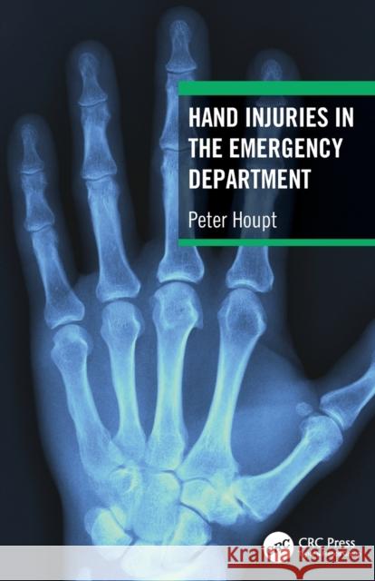Hand Injuries in the Emergency Department Peter Houpt 9781032322421 CRC Press - książka