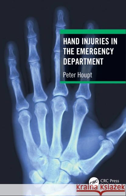 Hand Injuries in the Emergency Department Peter Houpt 9781032322438 CRC Press - książka