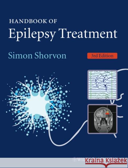 Handbook Epilepsy Treatment 3e Shorvon, Simon 9781405198189 Wiley-Blackwell - książka