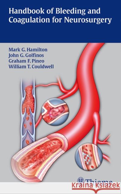 Handbook of Bleeding and Coagulation for Neurosurgery Mark Hamilton W. T. Couldwell John G. Golfinos 9781604065442 Thieme Medical Publishers - książka