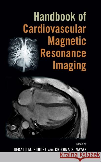 Handbook of Cardiovascular Magnetic Resonance Imaging Gerald M. Pohost Krishna S. Nayak 9780824758417 Informa Healthcare - książka