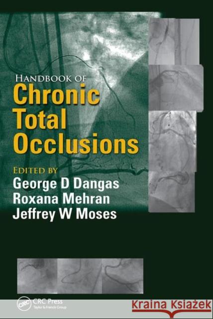 Handbook of Chronic Total Occlusions  9780367452957 Taylor and Francis - książka