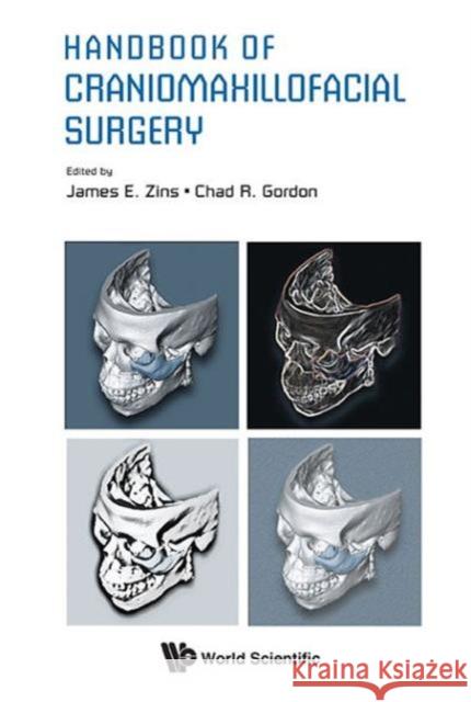 Handbook of Craniomaxillofacial Surgery Zins, James E. 9789814295093 World Scientific Publishing Company - książka