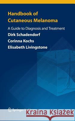 Handbook of Cutaneous Melanoma: A Guide to Diagnosis and Treatment Schadendorf, Dirk 9781908517975 Springer Healthcare - książka