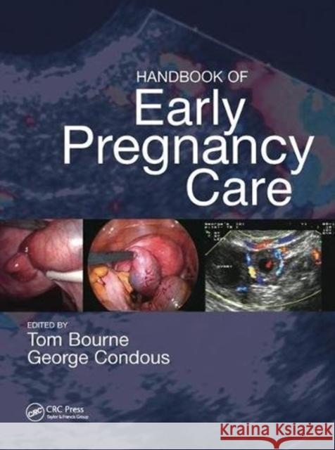 Handbook of Early Pregnancy Care  9781138457010 Taylor and Francis - książka