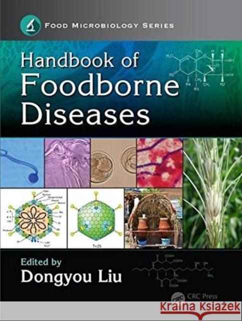 Handbook of Foodborne Diseases Dongyou Liu 9781138036307 CRC Press - książka