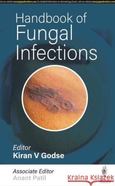 Handbook of Fungal Infections Anant Patil 9789354659546 Jaypee Brothers Medical Publishers - książka