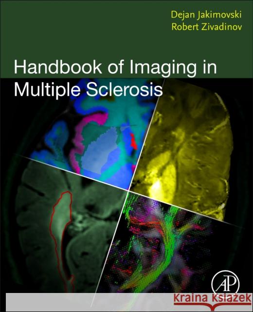 Handbook of Imaging in Multiple Sclerosis  9780323957397 Elsevier Science & Technology - książka