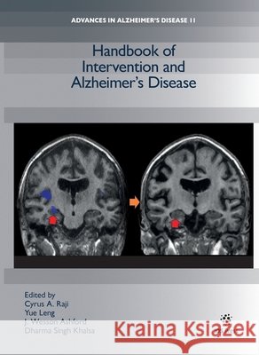Handbook of Intervention and Alzheimer’s Disease Dharma Singh Khalsa, J. Wesson Ashford, Yue Leng 9781643685007 SAGE Publications (RJ) - książka