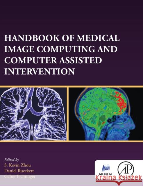 Handbook of Medical Image Computing and Computer Assisted Intervention Kevin Zhou Daniel Rueckert Gabor Fichtinger 9780128161760 Academic Press - książka