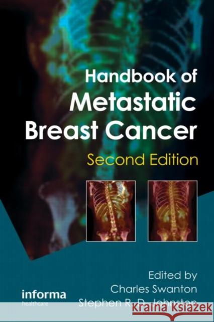 Handbook of Metastatic Breast Cancer Stephen R. D. Johnston Charles Swanton 9781841848112 Informa Healthcare - książka