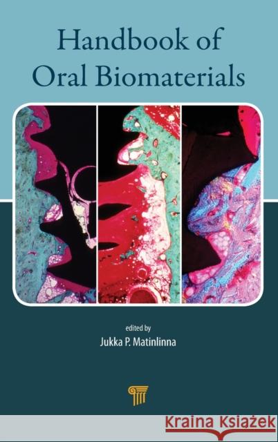 Handbook of Oral Biomaterials Jukka Pekka Matinlinna 9789814463126 Pan Stanford Publishing - książka