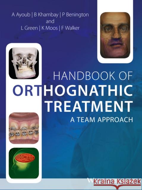 Handbook of Orthognathic Treatment: A Team Approach Ayoub, Ashraf 9780470659052 John Wiley & Sons - książka