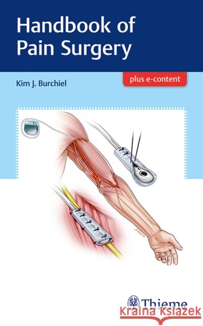 Handbook of Pain Surgery Kim Burchiel 9781626238718 Thieme Medical Publishers - książka