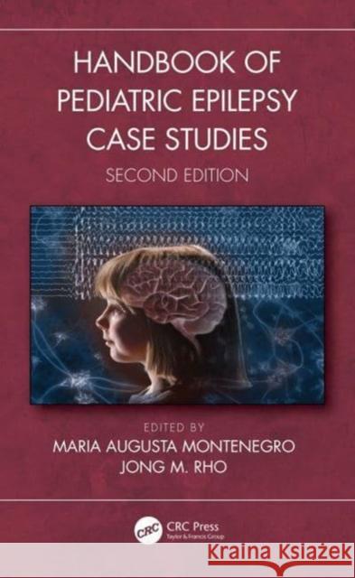 Handbook of Pediatric Epilepsy Case Studies, Second Edition Maria Augusta Montenegro Jong M. Rho 9781032283548 CRC Press - książka