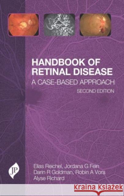 Handbook of Retinal Disease Alyse Richard 9781787791701 JP Medical Ltd - książka