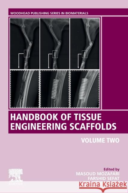 Handbook of Tissue Engineering Scaffolds: Volume Two Mozafari, Masoud 9780081025611 Woodhead Publishing - książka