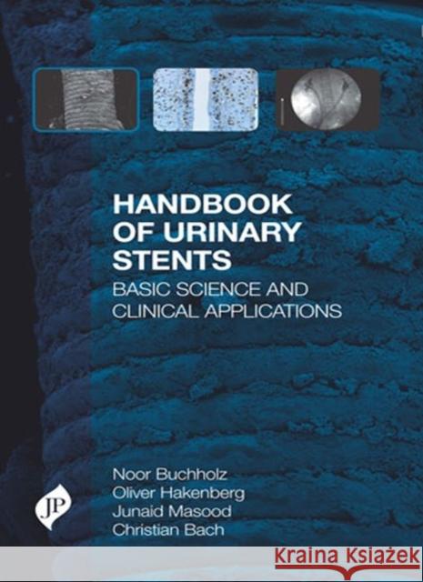 Handbook of Urinary Stents Buchholz, Noor 9781907816659 JP Medical Ltd - książka