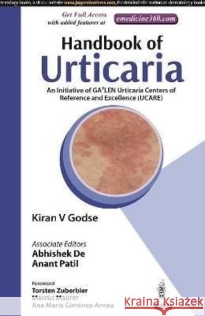 Handbook of Urticaria: An Initiative of GA2LEN Urticaria Centers of Reference and Excellence (UCARE) Kiran V Godse Abhishek De Anant Patil 9789354650260 Jaypee Brothers Medical Publishers - książka